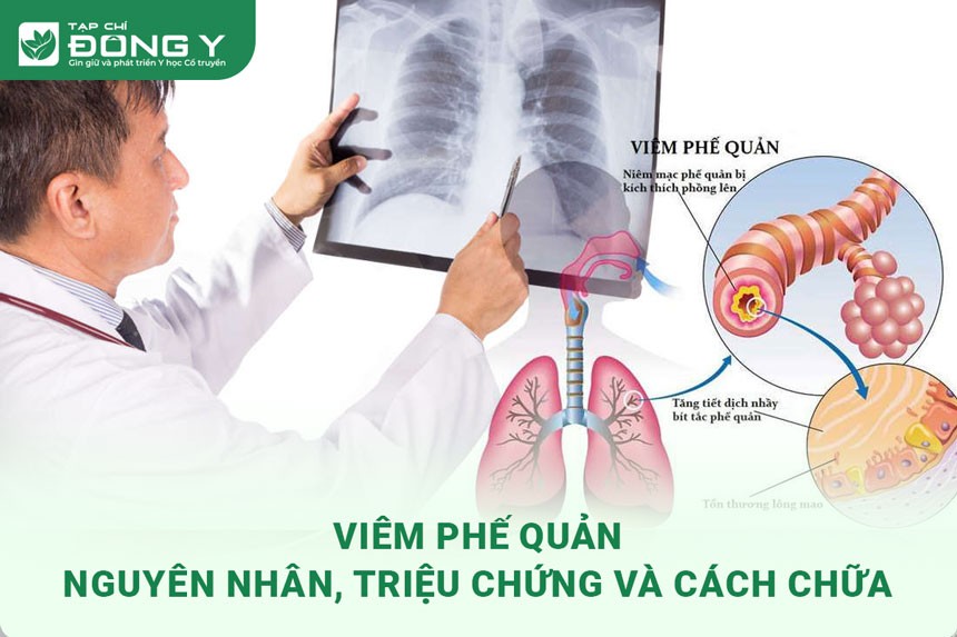Image Viem Phe Quan 1
