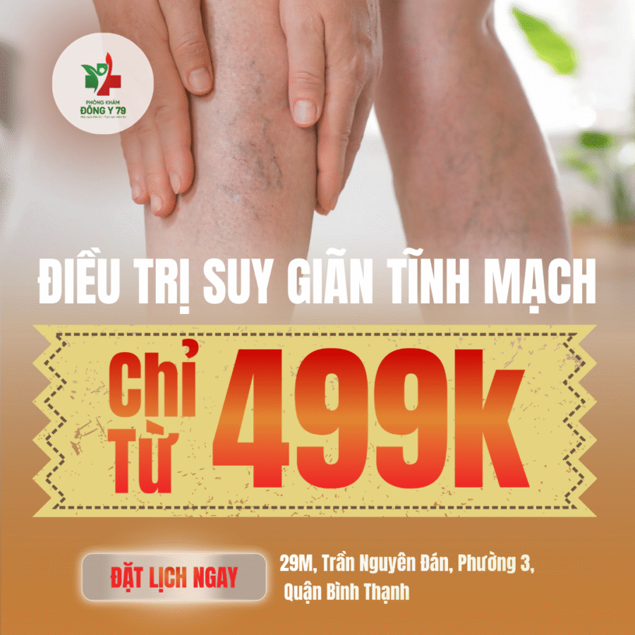 điều Trị Suy Giãn Tĩnh Mạch